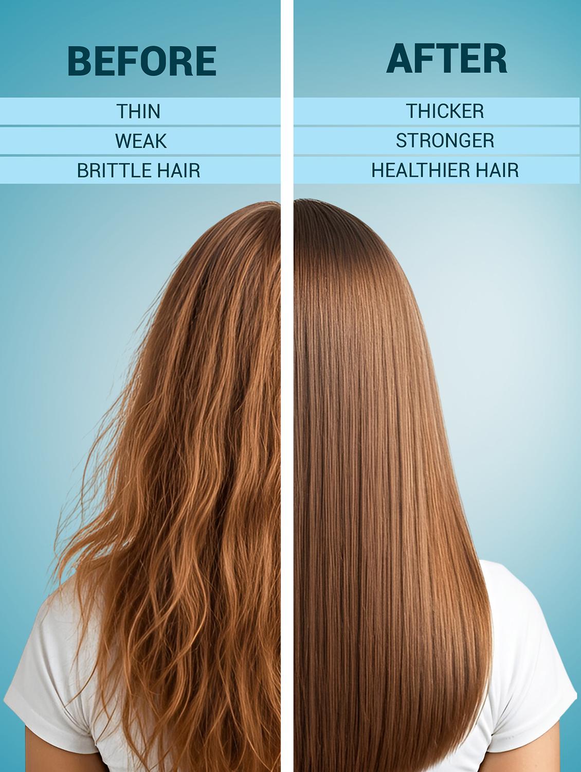 hair growth serum with anagain redensyl - 21987907 - Standard Image - 3