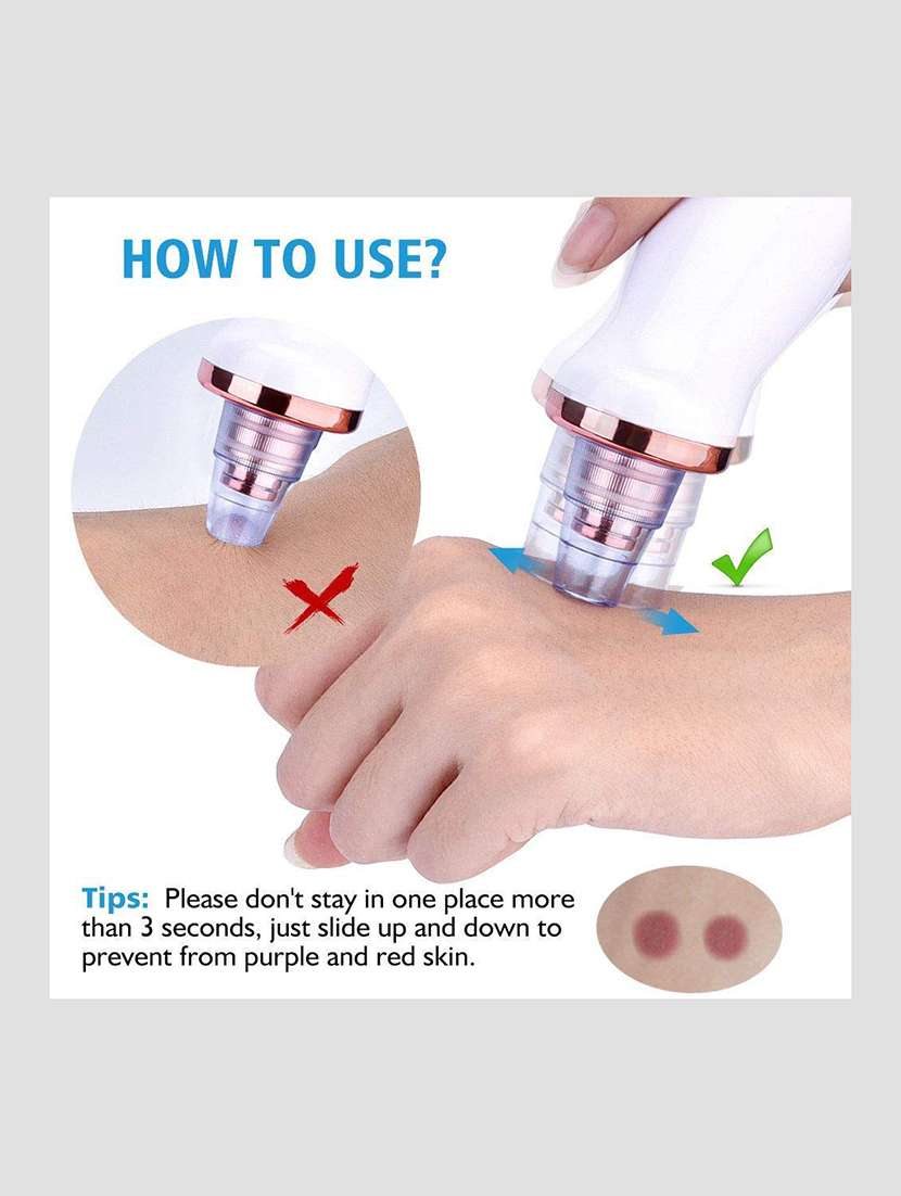 6 in 1 multi-function blackhead remover tools - 22477772 -  Standard Image - 3